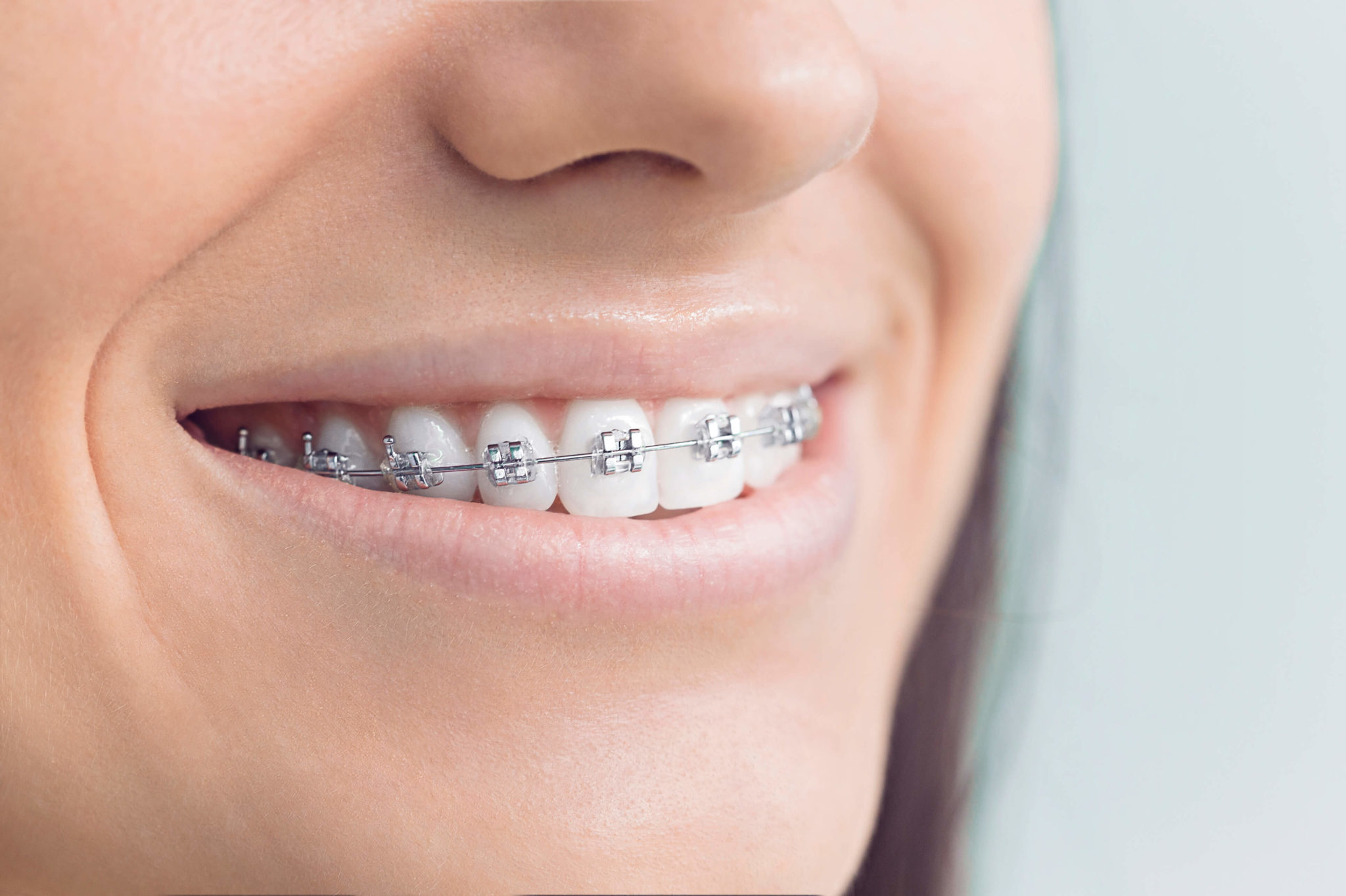 Atasehir Dental Clinic - Ataşehir Orthodontics